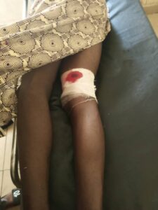 One of the injured person